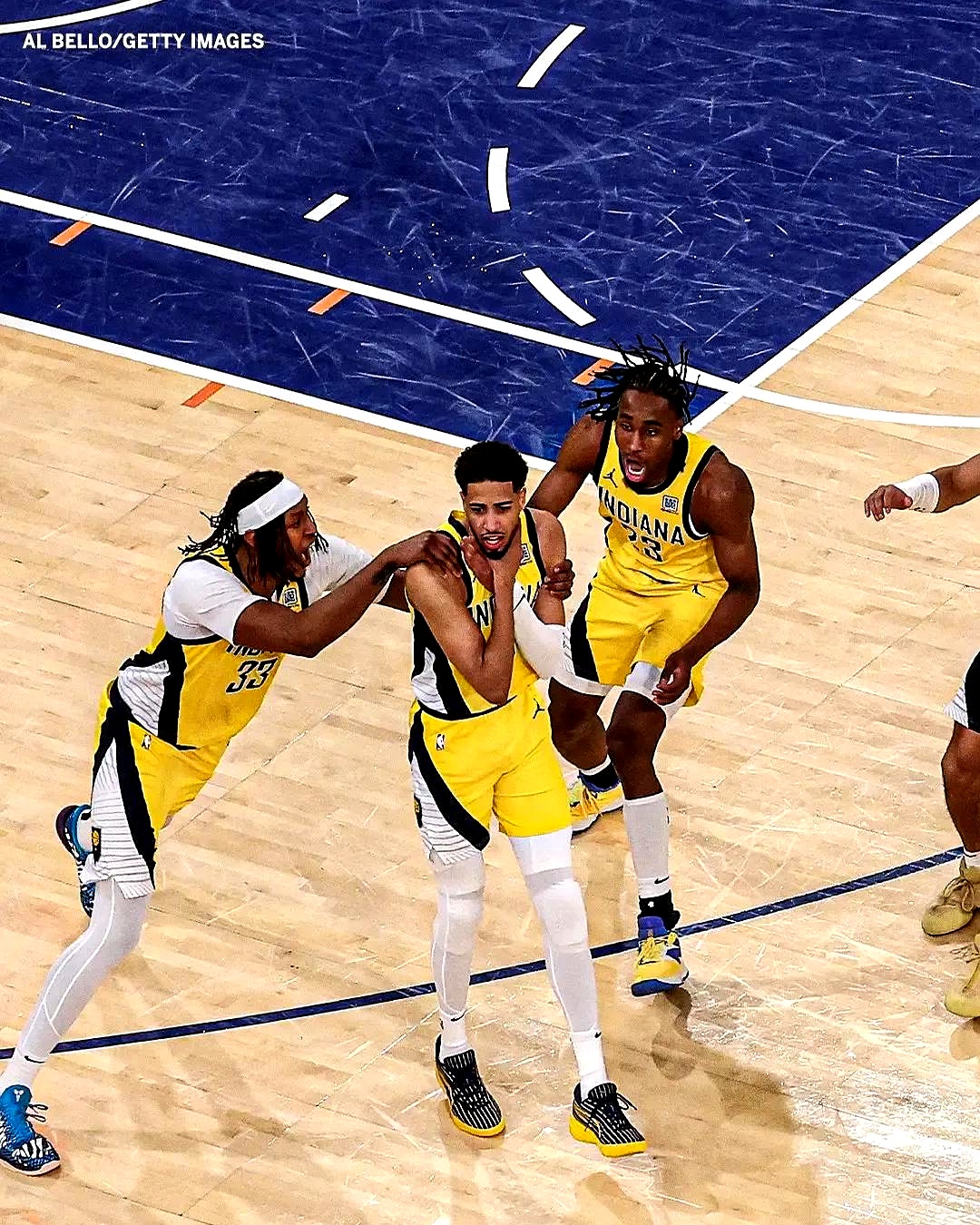 印第安纳步行者迎欧篮联关键赛；集结日复出首秀；媒体盛赞；身体对抗强度拉满的简单介绍